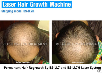 прибор Регровтх волос лазера диода 650нм/670нм для обработки выпадения волос