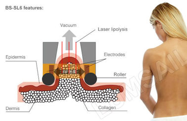 Замораживание Крйолиполысис жирное уменьшая систему тела машины более тонкую контуря для жирный разрешать