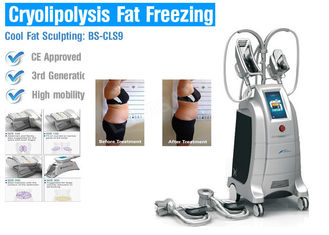 Тело Крйолиполысис жирное замерзая уменьшая машину отсутствие хирургии для уменьшения тела