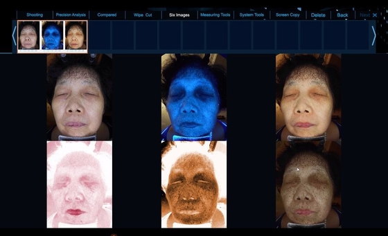 Спектр 6 видит более ясное оборудование анализа кожи проблемы кожи лицевое