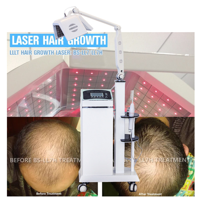 Терапия лазера терапией ЛЛЛТ волос растет волосы с реальной машиной Регровтх волос лазера диодов