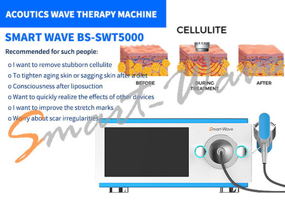 Машина терапией акустической волны 6 передатчиков для удаления меток простирания/переформовать тела