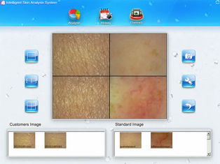 Мини лицевой интерфейс УСБ прибора 7200К красоты машины анализа кожи для дома