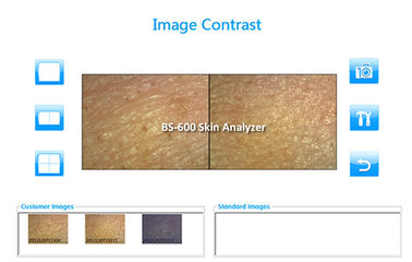 Мини лицевой интерфейс УСБ прибора 7200К красоты машины анализа кожи для дома