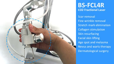 Машина лазера СО2 углекислого газа частичная для обработки шрама кожи