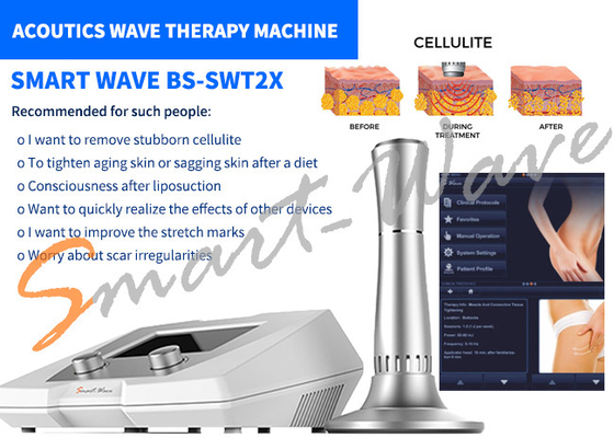 Удаление целлюлита машины терапией акустической волны салона красоты БС-СВТ2С гарантия 1 года