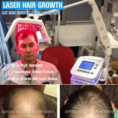 вертикальное оборудование лазера диода 650nm для Regrowth волос